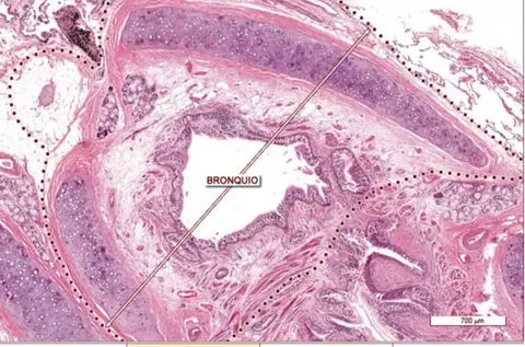 Preparación: Bronquio Intrapulmonar