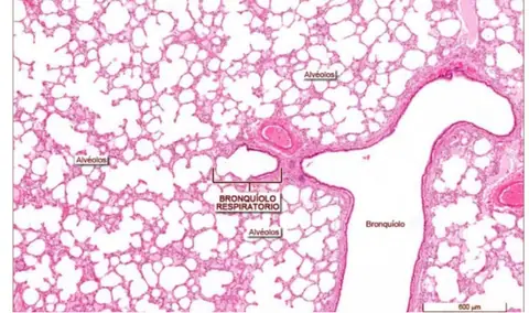Preparación: Bronquiolo Respiratorio