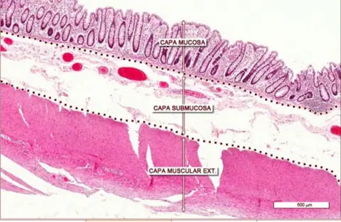 Preparación: Colon