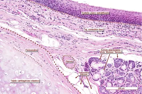 Preparación: Epiglotis