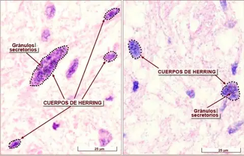 Preparación: Neurohipófisis
