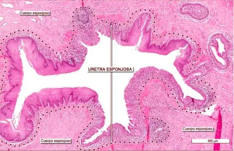 Preparación: Uretra masculina
